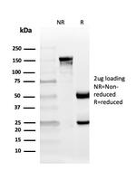 CD10 (Membrane Metalloendopeptidase) Antibody in SDS-PAGE (SDS-PAGE)