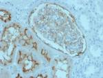 CD10 (Membrane Metalloendopeptidase) Antibody in Immunohistochemistry (Paraffin) (IHC (P))