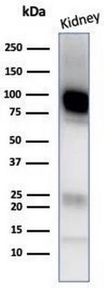 CD10 (Membrane Metalloendopeptidase) Antibody in Western Blot (WB)