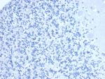 CD10 (Membrane Metalloendopeptidase) Antibody in Immunohistochemistry (Paraffin) (IHC (P))