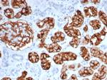 CD10 (Membrane Metalloendopeptidase) Antibody in Immunohistochemistry (Paraffin) (IHC (P))