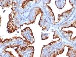 CD10 (Membrane Metalloendopeptidase) Antibody in Immunohistochemistry (Paraffin) (IHC (P))