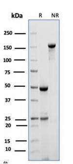 CD10 (Membrane Metalloendopeptidase) Antibody in SDS-PAGE (SDS-PAGE)