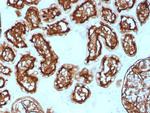 CD10 (Membrane Metalloendopeptidase) Antibody in Immunohistochemistry (Paraffin) (IHC (P))