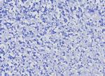 CD10 (Membrane Metalloendopeptidase) Antibody in Immunohistochemistry (Paraffin) (IHC (P))