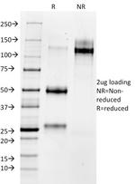 MMP3 (Marker of Metastasis and Rheumatoid Arthritis) Antibody in SDS-PAGE (SDS-PAGE)