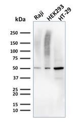 MMP3 Antibody in Western Blot (WB)