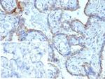 MMP3 (Marker of Metastasis and Rheumatoid Arthritis) Antibody in Immunohistochemistry (Paraffin) (IHC (P))