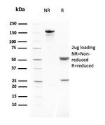 MMP3 (Marker of Metastasis and Rheumatoid Arthritis) Antibody in SDS-PAGE (SDS-PAGE)