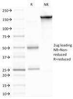 MMP9 (Matrix Metalloproteinase 9) Antibody in SDS-PAGE (SDS-PAGE)