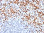 MMP9 (Matrix Metalloproteinase 9) Antibody in Immunohistochemistry (Paraffin) (IHC (P))