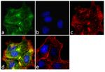 MMP2 Antibody in Immunocytochemistry (ICC/IF)