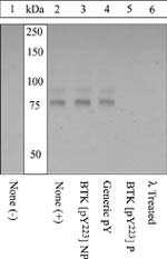 Phospho-Btk (Tyr223) Antibody in Western Blot (WB)