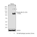 Phospho-Btk (Tyr223) Antibody in Western Blot (WB)