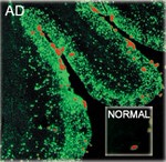 beta Amyloid (1-40) Antibody