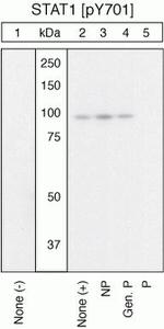 Phospho-STAT1 (Tyr701) Antibody