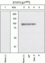 Phospho-STAT5 alpha (Tyr694) Antibody