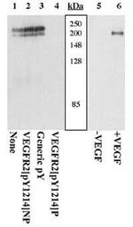 Phospho-VEGF Receptor 2 (Tyr1214) Antibody