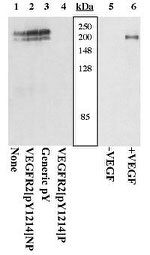 Phospho-VEGF Receptor 2 (Tyr1214) Antibody in Western Blot (WB)