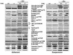 Phospho-Vinculin (Tyr1065) Antibody in Western Blot (WB)