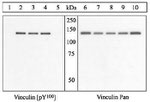 Phospho-Vinculin (Tyr100) Antibody in Western Blot (WB)