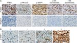 Phospho-PRAS40 (Thr246) Antibody in Immunohistochemistry (IHC)