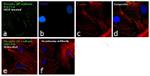 Phospho-VE-cadherin (Tyr731) Antibody in Immunocytochemistry (ICC/IF)