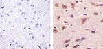 Phospho-Aurora A (Thr288) Antibody in Immunohistochemistry (Paraffin) (IHC (P))