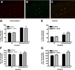 beta Amyloid (1-40) Antibody in Immunohistochemistry (IHC)