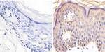 Phospho-RAC1/CDC42 (Ser71) Antibody in Immunohistochemistry (Paraffin) (IHC (P))