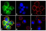 Phospho-Syk (Tyr323, Tyr317) Antibody