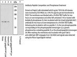 Phospho-SMAD2 (Ser465, Ser467) Antibody in Western Blot (WB)