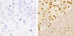 Phospho-SMAD2 (Ser465, Ser467) Antibody in Immunohistochemistry (Paraffin) (IHC (P))