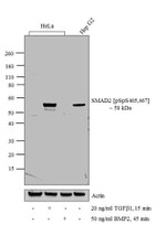 Phospho-SMAD2 (Ser465, Ser467) Antibody