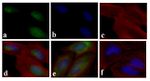 Phospho-SMAD3 (Ser423, Ser425) Antibody