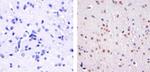 Phospho-ATF2 (Thr71) Antibody in Immunohistochemistry (Paraffin) (IHC (P))