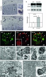 beta Amyloid (1-42) Antibody in Western Blot, Immunohistochemistry, Immunomicroscopy (WB, IHC, IM)