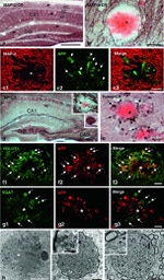 beta Amyloid (1-42) Antibody in Immunohistochemistry (IHC)