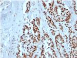 MSH2 Antibody in Immunohistochemistry (Paraffin) (IHC (P))