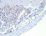 MSH2 Antibody in Immunohistochemistry (Paraffin) (IHC (P))