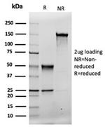 MSH2 Antibody in SDS-PAGE (SDS-PAGE)