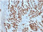 MSH2 Antibody in Immunohistochemistry (Paraffin) (IHC (P))