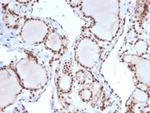 MSH2 Antibody in Immunohistochemistry (Paraffin) (IHC (P))