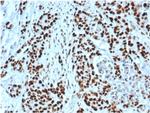 MSH2 Antibody in Immunohistochemistry (Paraffin) (IHC (P))