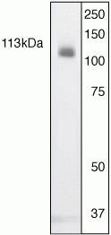 STAT2 Antibody in Western Blot (WB)