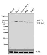 STAT2 Antibody in Western Blot (WB)