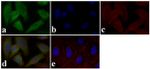 STAT5 alpha/beta Antibody in Immunocytochemistry (ICC/IF)