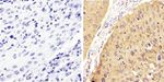 Phospho-STAT1 (Tyr701) Antibody in Immunohistochemistry (Paraffin) (IHC (P))