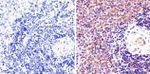 Phospho-STAT1 (Tyr701) Antibody in Immunohistochemistry (Paraffin) (IHC (P))