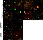 Phospho-IRS1 (Ser616) Antibody in Immunohistochemistry (Paraffin) (IHC (P))